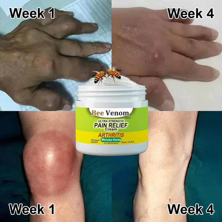 Bee Venom Joint and Bone Therapy Cream (Buy 1 Get 2 Free)